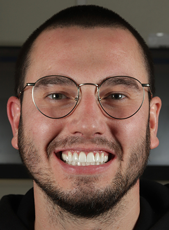 After - Meliora Dental 