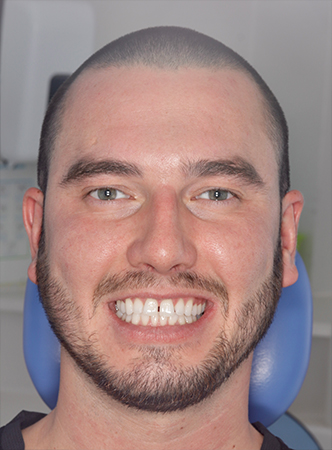 Before - Meliora Dental