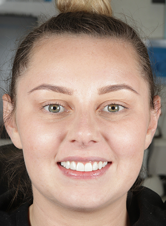 After - Meliora Dental 