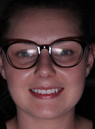 Before - Meliora Dental