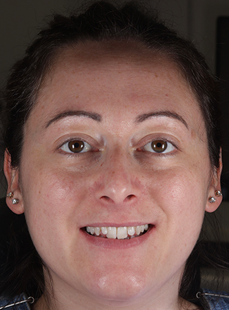 Before - Meliora Dental