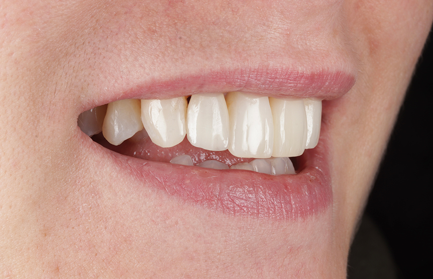 After - Meliora Dental