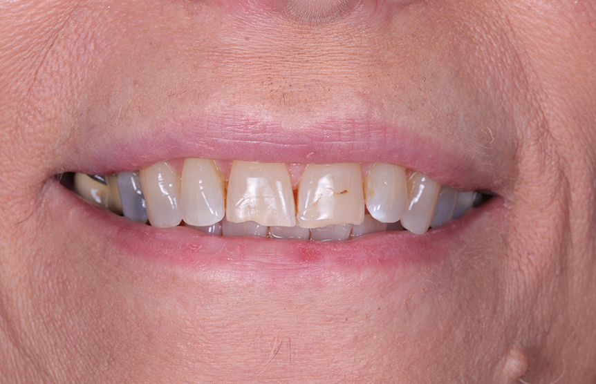 Before - Meliora Dental