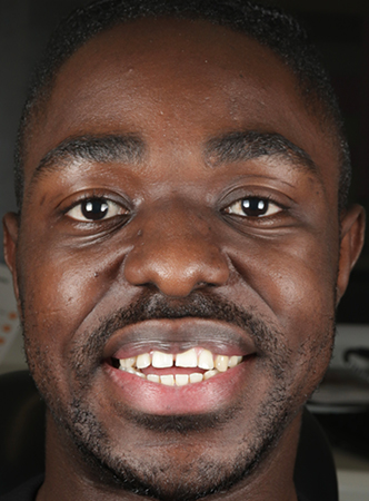 Before - Meliora Dental