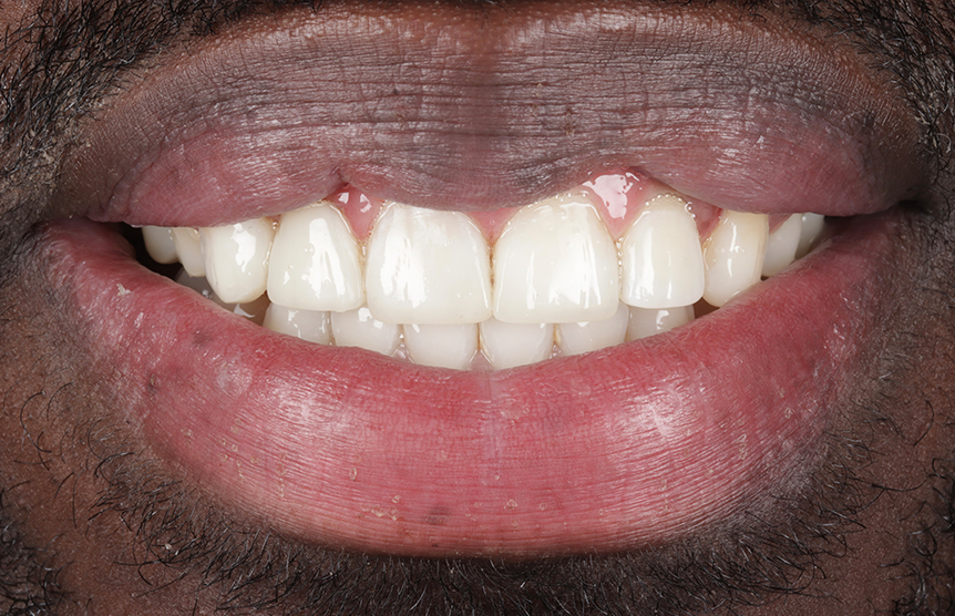 After - Meliora Dental