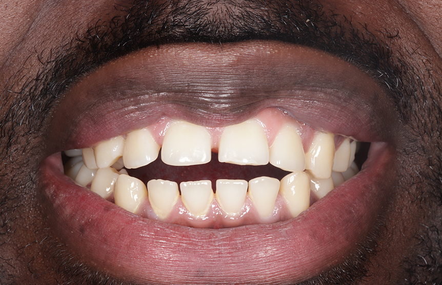 Before - Meliora Dental