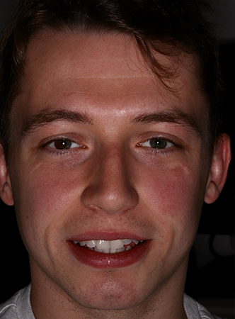 Before - Meliora Dental