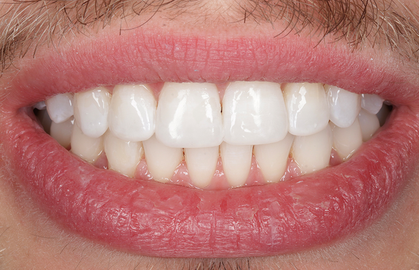 After - Meliora Dental