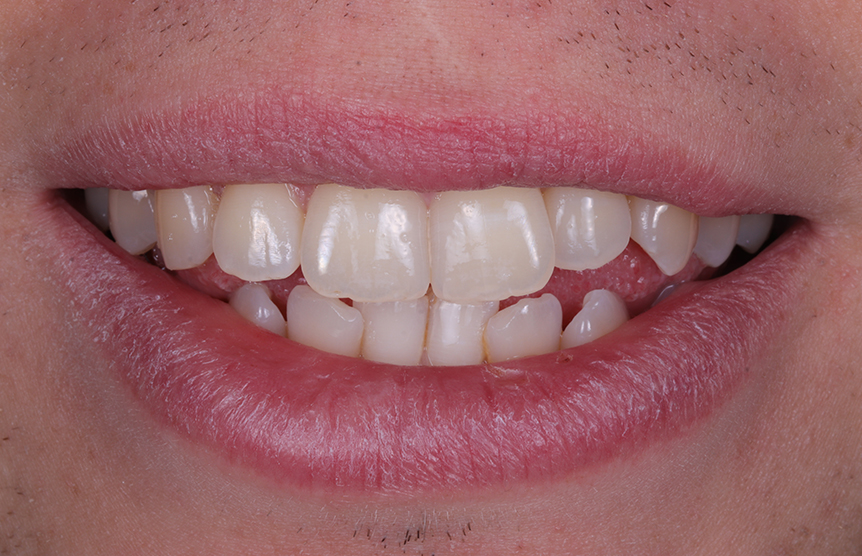 Before - Meliora Dental