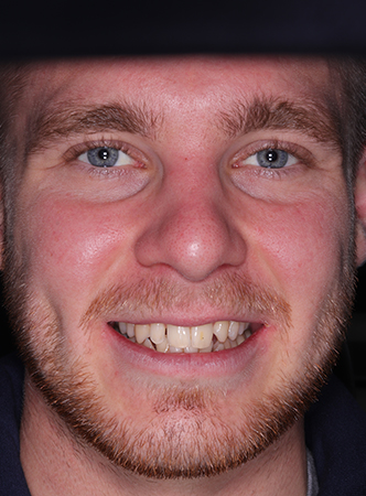 Before - Meliora Dental