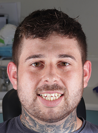 Before - Meliora Dental