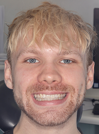 Before - Meliora Dental