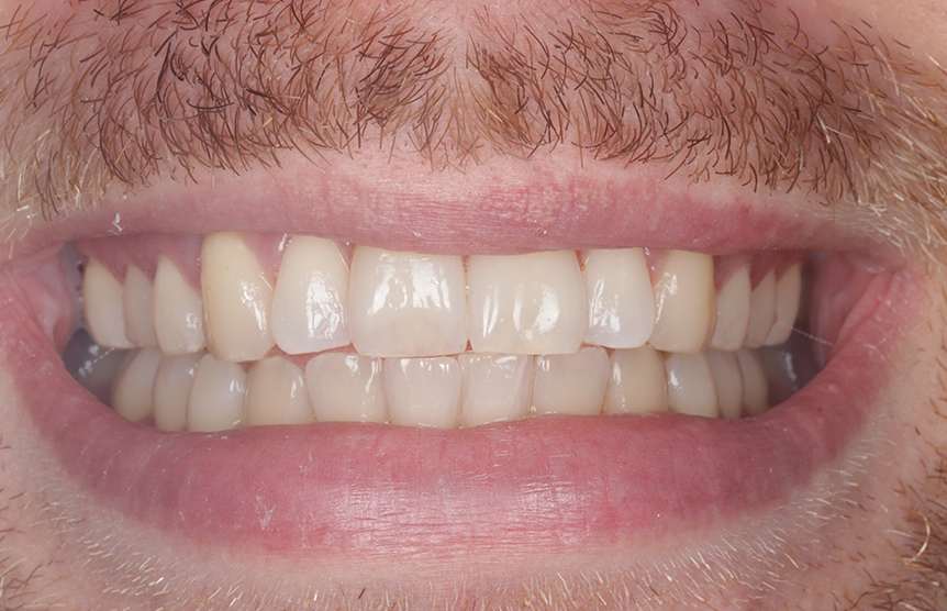 Before - Meliora Dental