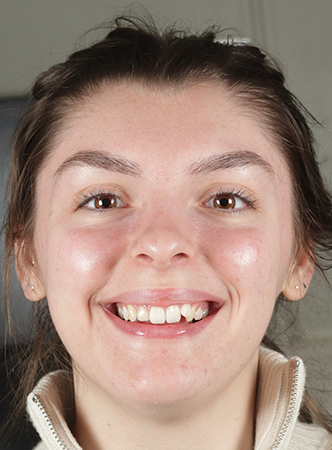 Before - Meliora Dental