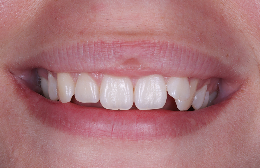 Before - Meliora Dental