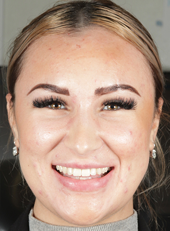 Before - Meliora Dental