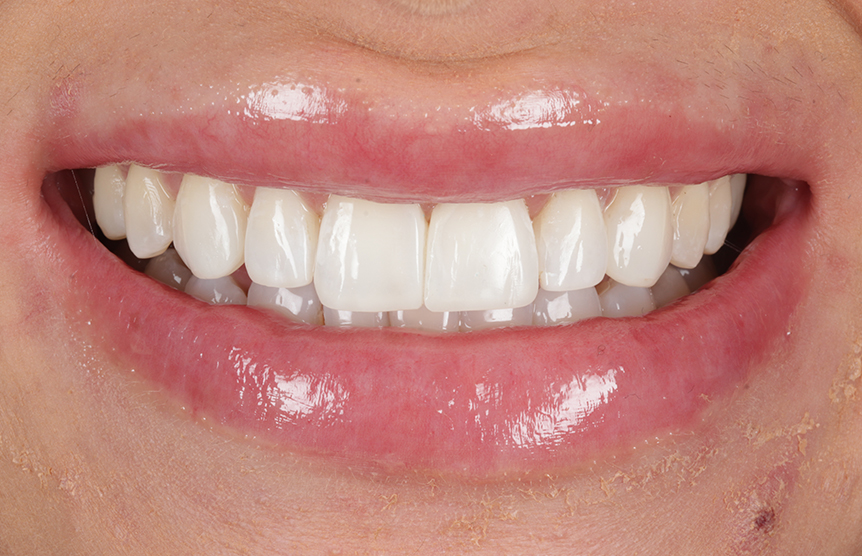 After - Meliora Dental