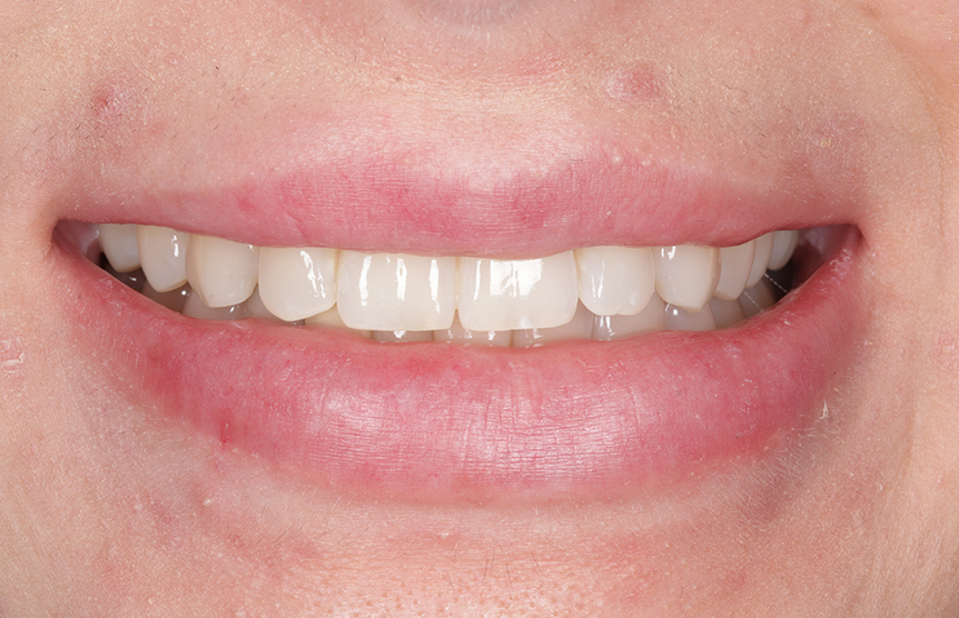 Before - Meliora Dental