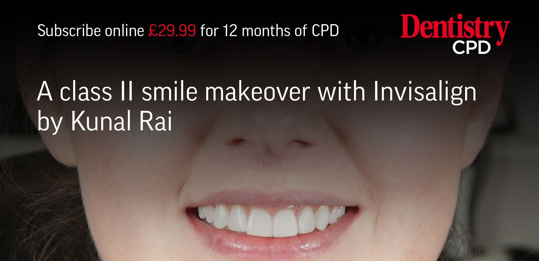 blog inner thumb : Meliora Dental