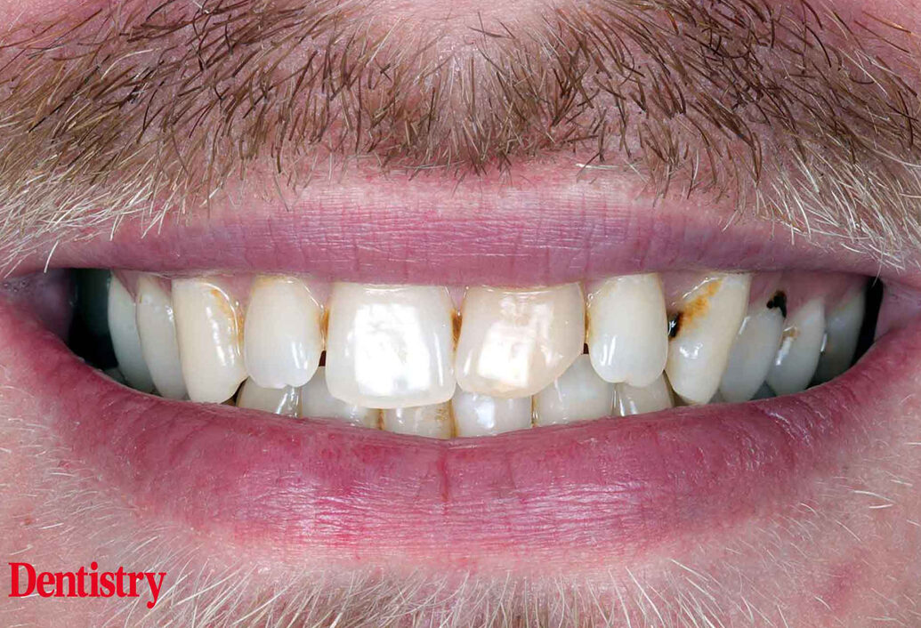 blog - Meliora Dental