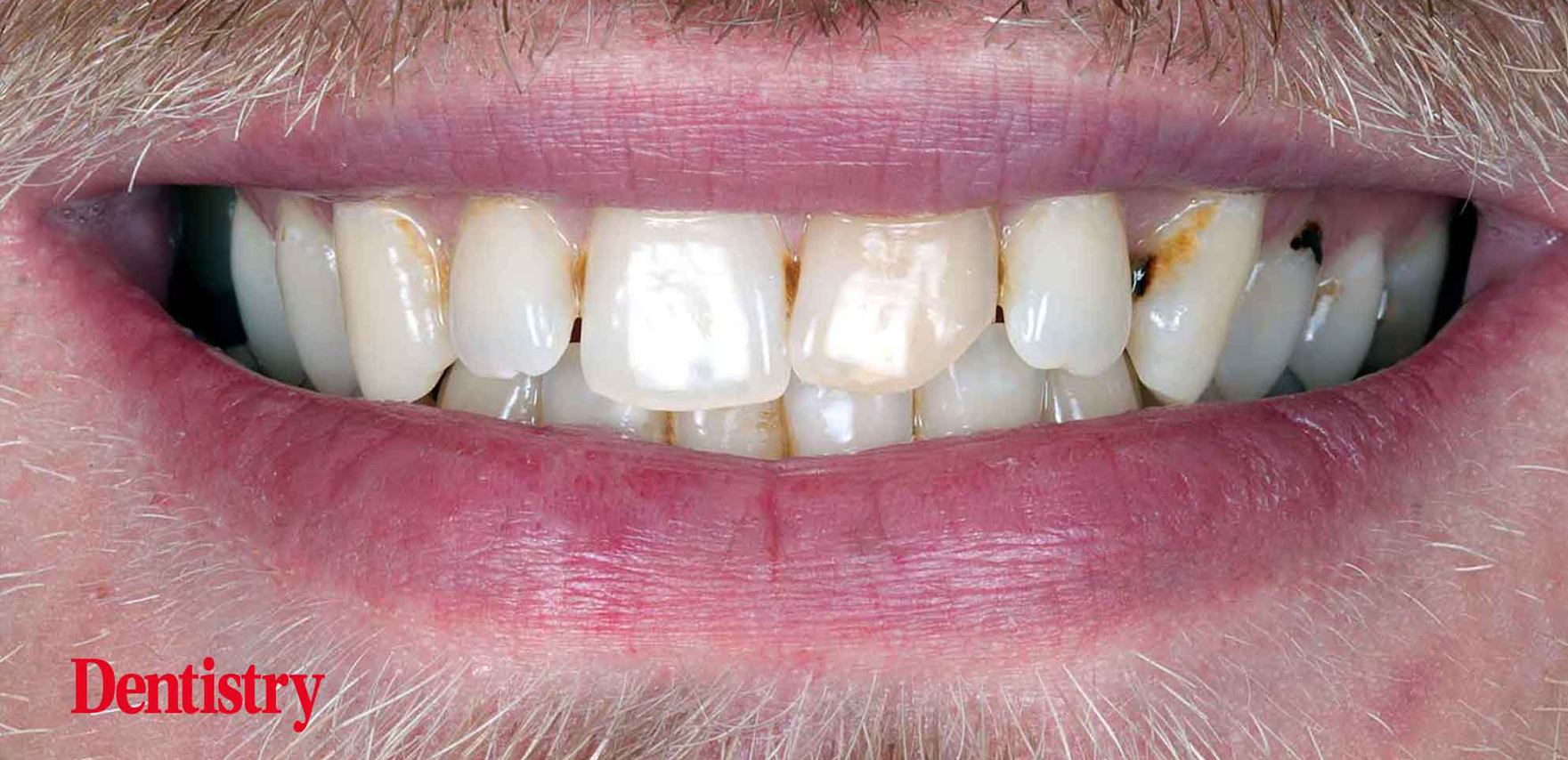 blog inner thumb : Meliora Dental