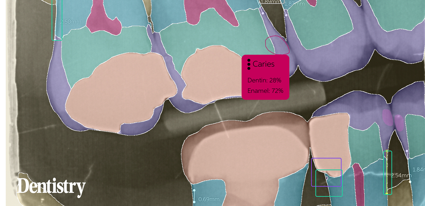 blog inner thumb : Meliora Dental