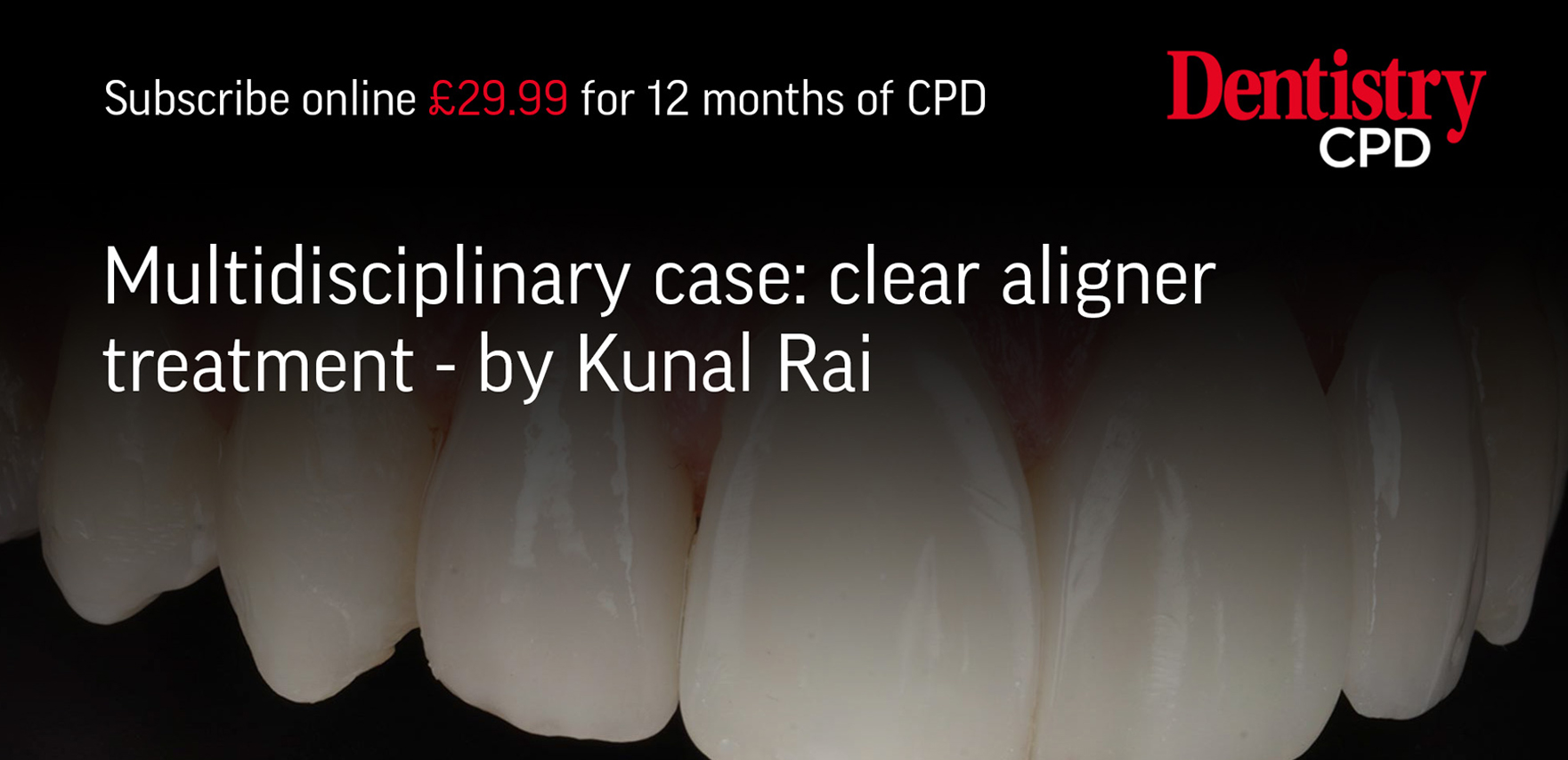 blog inner thumb : Meliora Dental